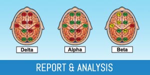 Brain Map Report